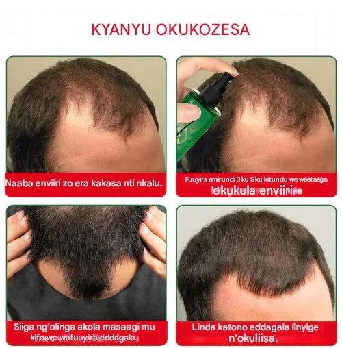 Hair Treatment Natural - YN