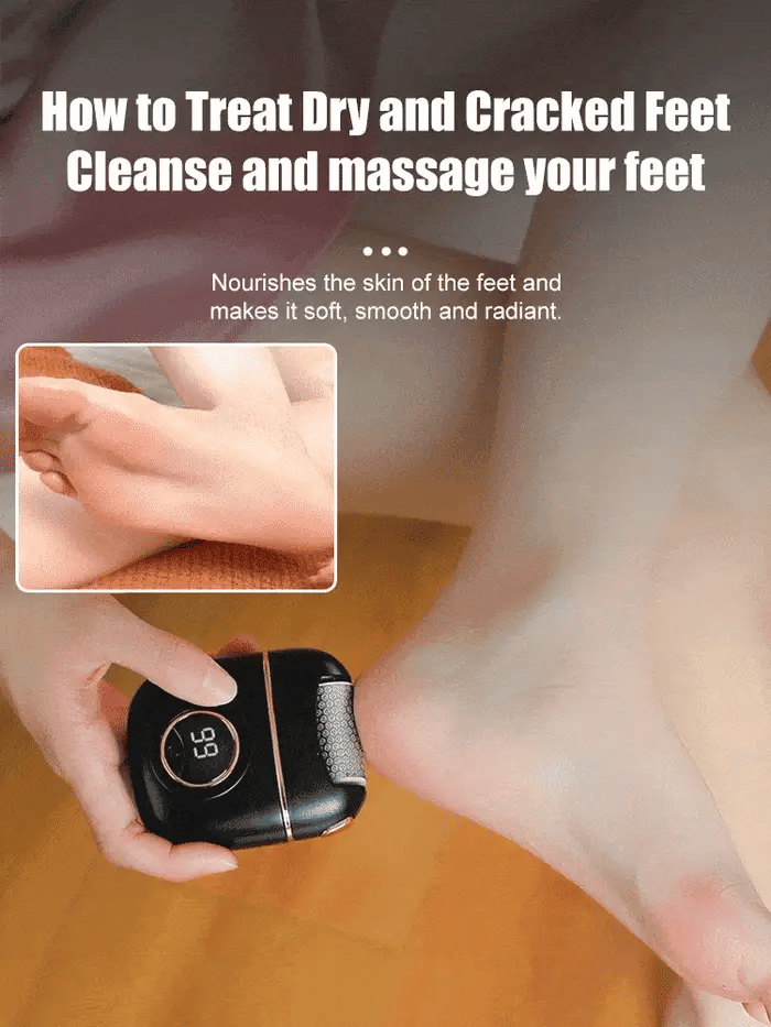 Digital Electric Foot Polisher - YN