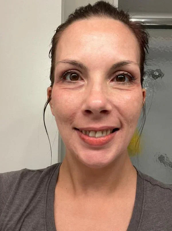 Yujia™ Melasma and Dark Spot Corrector Cream - YN