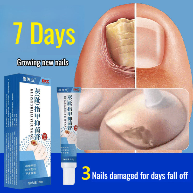 Fungal Nail Treatment Cream – Clear, Strong & Healthy Nails - YN