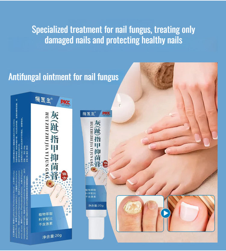 Fungal Nail Treatment Cream – Clear, Strong & Healthy Nails - YN